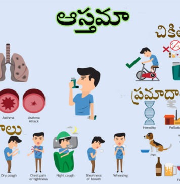 ఆస్తమా ఎన్ని రకాలు.. వ్యాధి కారణాలు, లక్షణాలు, రోగ నిర్థారణ, చికిత్స Asthma Causes Symptoms