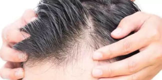 బట్టతల: జట్టు రాలుతోందా.? త్వరగా గుర్తించండీ.. చికిత్స అందించండి Why Do Men Go Bald