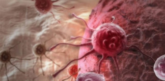 బ్లడ్ క్యాన్సర్.. లక్షణాలు.. చికిత్సా విధానాలు.. ఆహారం.. blood cancer