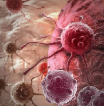 బ్లడ్ క్యాన్సర్.. లక్షణాలు.. చికిత్సా విధానాలు.. ఆహారం.. blood cancer