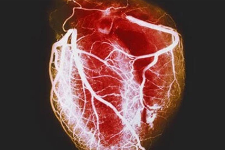 Echocardiagram Types