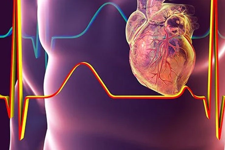 Echocardiagram