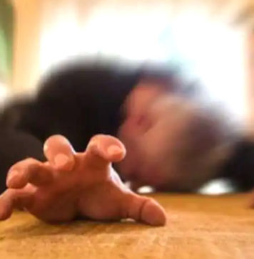 మూర్ఛవ్యాధి: లక్షణాలు, కారకాలు, నిర్థారణ, చికిత్స Epilepsy Symptoms Treatment