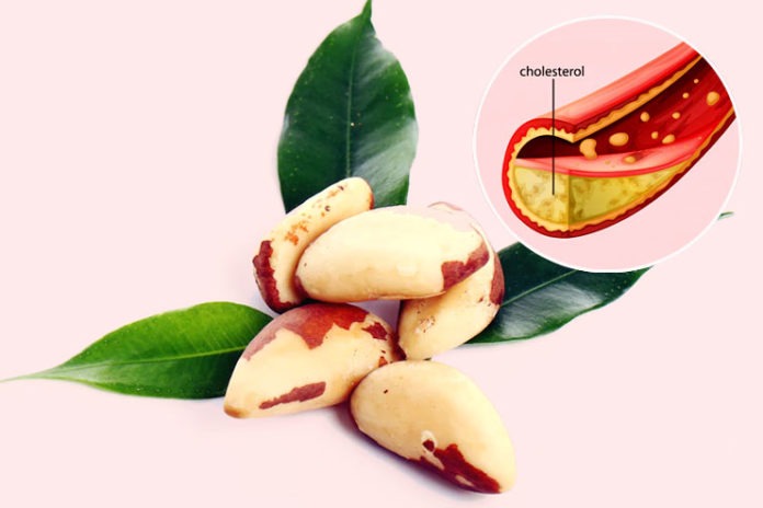 Brazil Nuts Keeps Bad Cholesterol Away