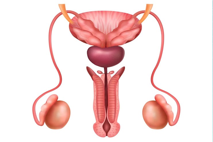 Hydrocele Symptoms