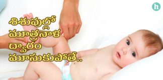 హైపోస్పాడియాస్ – లక్షణాలు, కారణాలు, చికిత్స - Hypospadias- Causes & Treatment in Telugu Hypospadias and Chordee