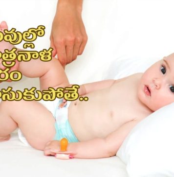 హైపోస్పాడియాస్ – లక్షణాలు, కారణాలు, చికిత్స Hypospadias and Chordee