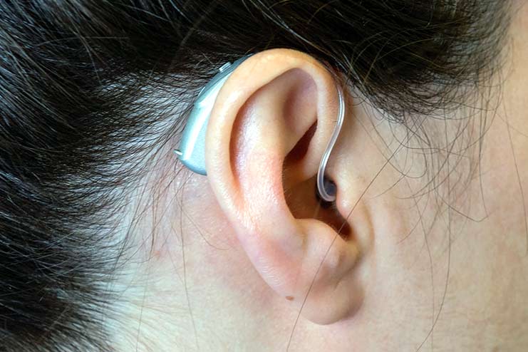 Open Fit Hearing Aid