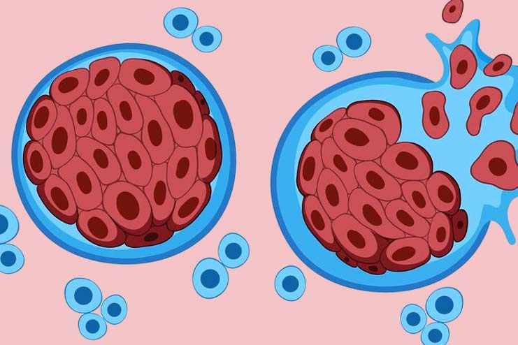 Collagen in Dormancy of Cancer Cells