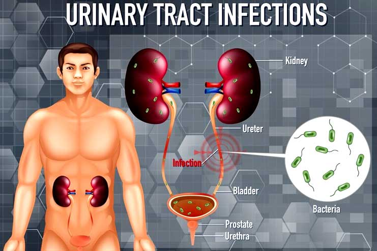 E coli Cases of UTIs