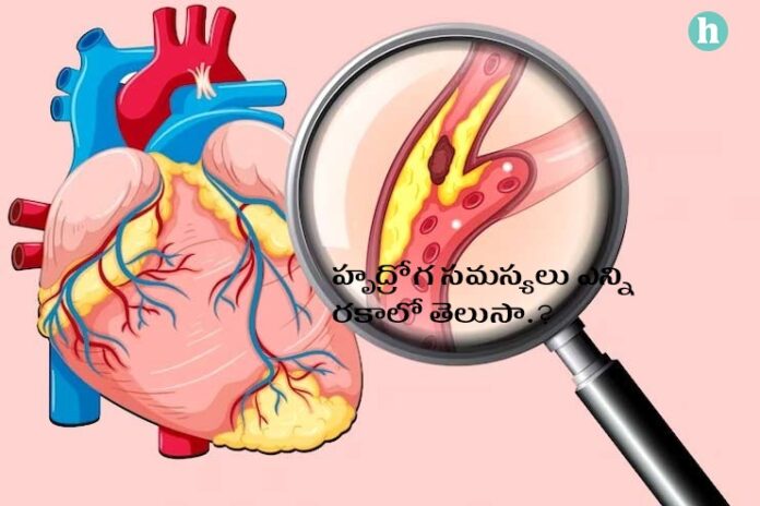 Cardiovascular diseases treatment prevention