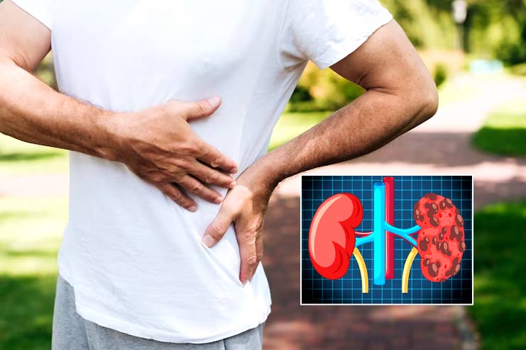 Who does kidney failure affect