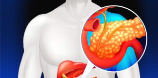 ప్యాంక్రియాటిక్ క్యాన్సర్ను సూచించే 6 సాధారణ లక్షణాలివే.! - 6 common symptoms that may indicate pancreatic cancer Pancreatic cancer symptoms