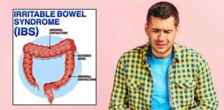 ప్రకోప ప్రేగు వ్యాధి కారకాలు, లక్షణాలు, చికిత్స - Irritable bowel syndrome: causes, symptoms, Treatment Irritable bowel syndrome
