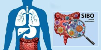 చిన్నప్రేగులో అధిక బ్యాక్టీరియా పెరుగుదల కారకాలు, నిర్థారణ, చికిత్స - Demystifying SIBO: Insights into Diagnosis and Effective Treatments Demystifying SIBO