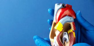 కర్ణిక సెప్టెల్ లోపమంటే ఏంటీ.? రకాలు, నిర్థారణ, చికిత్స, నివారణ - What Is an Atrial Septal Defect? Types, Diagnosis, Treatment, Prevention Atrial Septal Defect