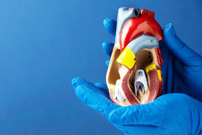 Atrial Septal Defect