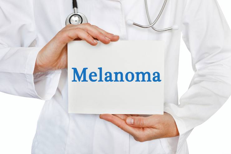 Risk factors of Melanoma