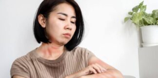 శీతాకాల చర్మ రుగ్మతలు: కారకాలు, చికిత్స, నివారణ - Winter Skin Diseases: Rash Causes, Treatment and Prevention Winter Skin Diseases