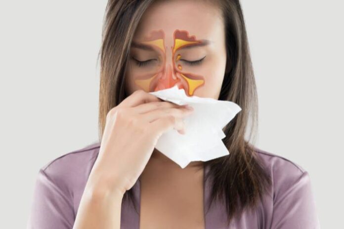 Acute Sinusitis