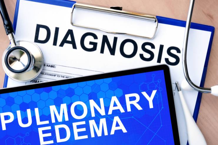 Diagnosis of pulmonary edema