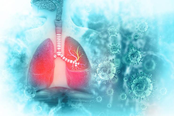 How air pollution contributes to lung disease