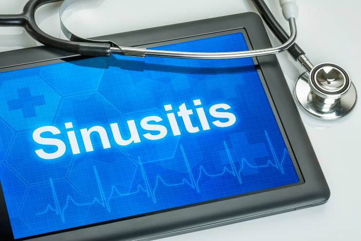 How is Acute Sinusitis diagnosied