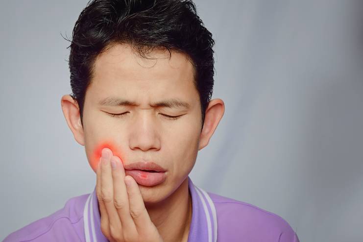 Mouth Ulcer