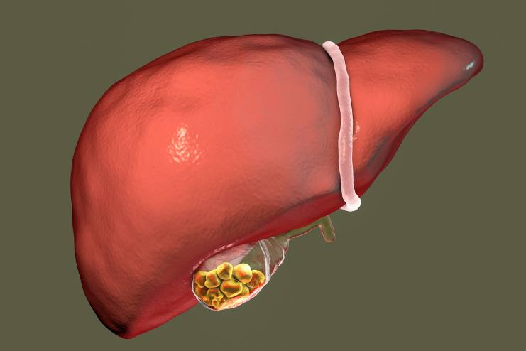 Post-hepatic jaundice treatment