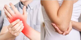 కార్పల్, క్యూబిటల్ టన్నెల్ సిండ్రోమ్ అంటే ఏమిటీ.? వాటి మధ్య తేడా.? - Carpal and Cubital tunnel syndrome, What's the Difference? Carpal and Cubital tunnel syndrome