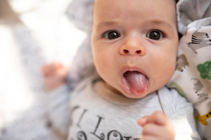 Cause of black tongue in children