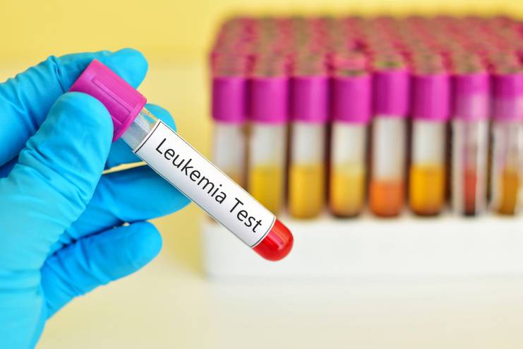 Childhood leukemia diagnostic tests