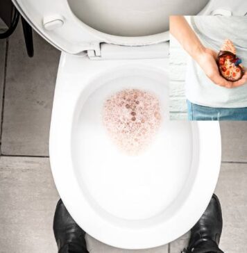 మూత్రంలో నురగ.? కిడ్నీ సమస్యకు సంకేతమా.? Chronic foamy urine - A sign of kidney problem