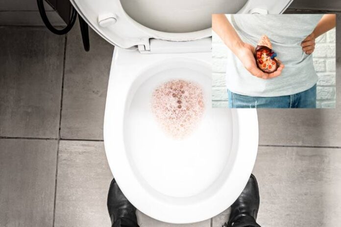 Chronic foamy urine - A sign of kidney problem