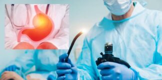 ఎండోస్కోపిక్ సర్జరీ: జీర్ణశయాంతర చికిత్సలో విప్లవం - Endoscopic Surgery: A revolutionary treatment in gastrointestine Endoscopic Surgery treatment in gastrointestine