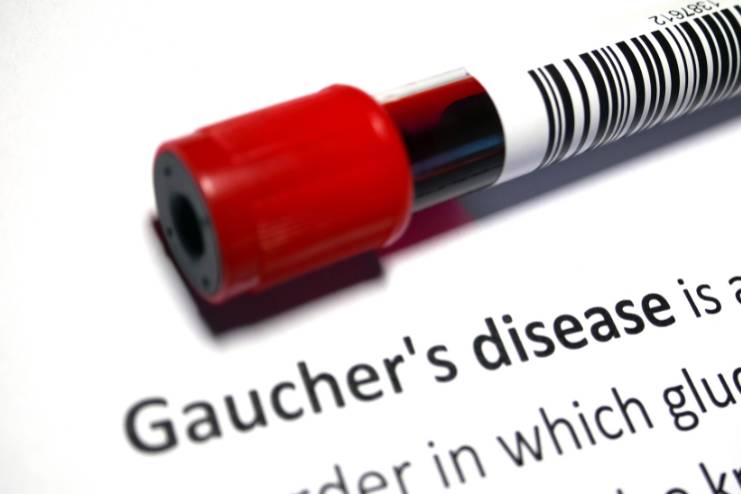 Gaucher Disease Type-3