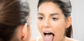 నాలుకపై నల్ల మచ్చలను సహజంగా వదిలించుకోండిలా.! - Natural Ways to Get Rid of Black Spots on Your Tongue Get Rid of Black Spots on Your Tongue