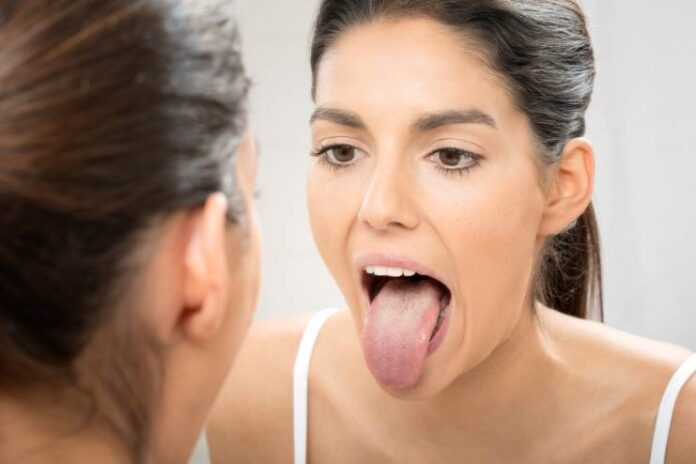 Get Rid of Black Spots on Your Tongue