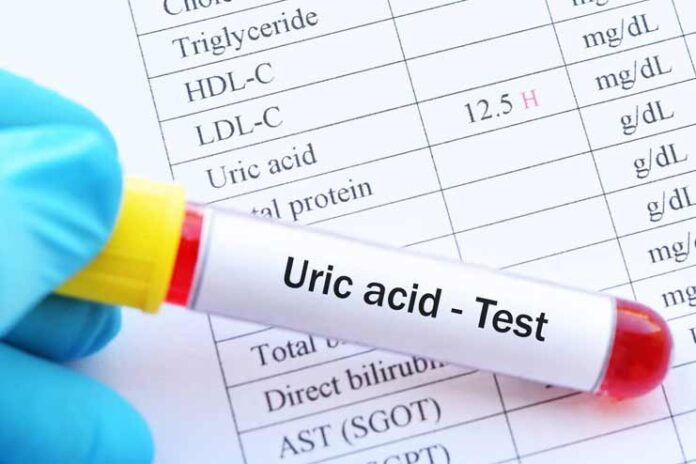 High Uric Acid Levels