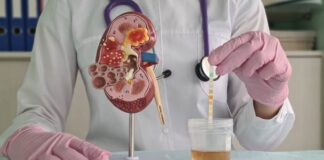 ప్రోటీన్యూరియా : కారణాలు, లక్షణాలు, నిర్థారణ, చికిత్స - Proteinuria - Causes, Symptoms, Diagnosis and Treatment Proteinuria Causes Symptoms Diagnosis