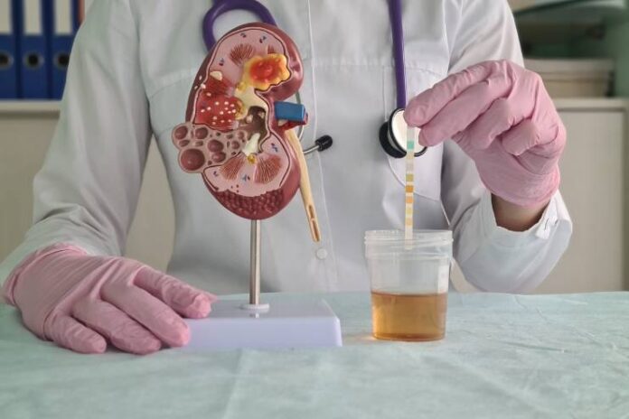 Proteinuria Causes Symptoms Diagnosis