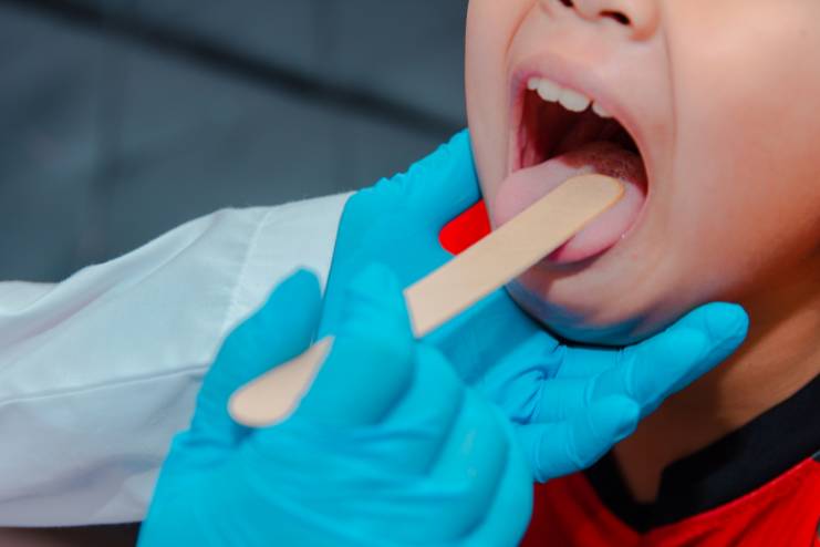 Treatment of black tongue in children