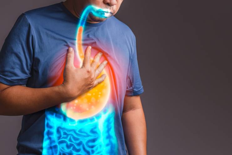 What does Acid Reflux mean