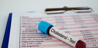 కొలెస్ట్రాల్ టెస్ట్: ఎవరెవరు ఎప్పుడెప్పుడు పరీక్షించుకోవాలి.? - Cholesterol Testing: Who Needs to Be Screened and When? Cholesterol Testing
