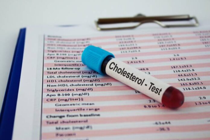 Cholesterol Testing