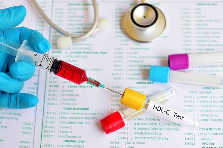 HDL Cholesterol