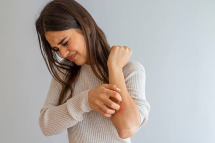 Pellagra Symptoms Causes