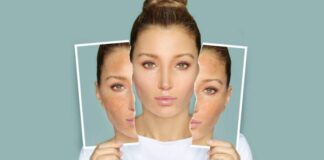 చర్మం రంగు మారిందా.? కారణాలు ఏమిటో తెలుసుకుందామా.? - What is meant by Skin Discolouration? List out the Reasons Skin Discolouration Reasons