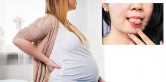 గర్భధారణ సమయంలో నాలుక పుండ్లుతో వ్యవహరించండిలా.! - Dealing with Tongue Sores During Pregnancy Tongue Sores During Pregnancy