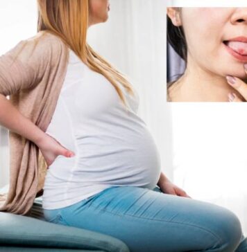 గర్భధారణ సమయంలో నాలుక పుండ్లుతో వ్యవహరించండిలా.! Tongue Sores During Pregnancy